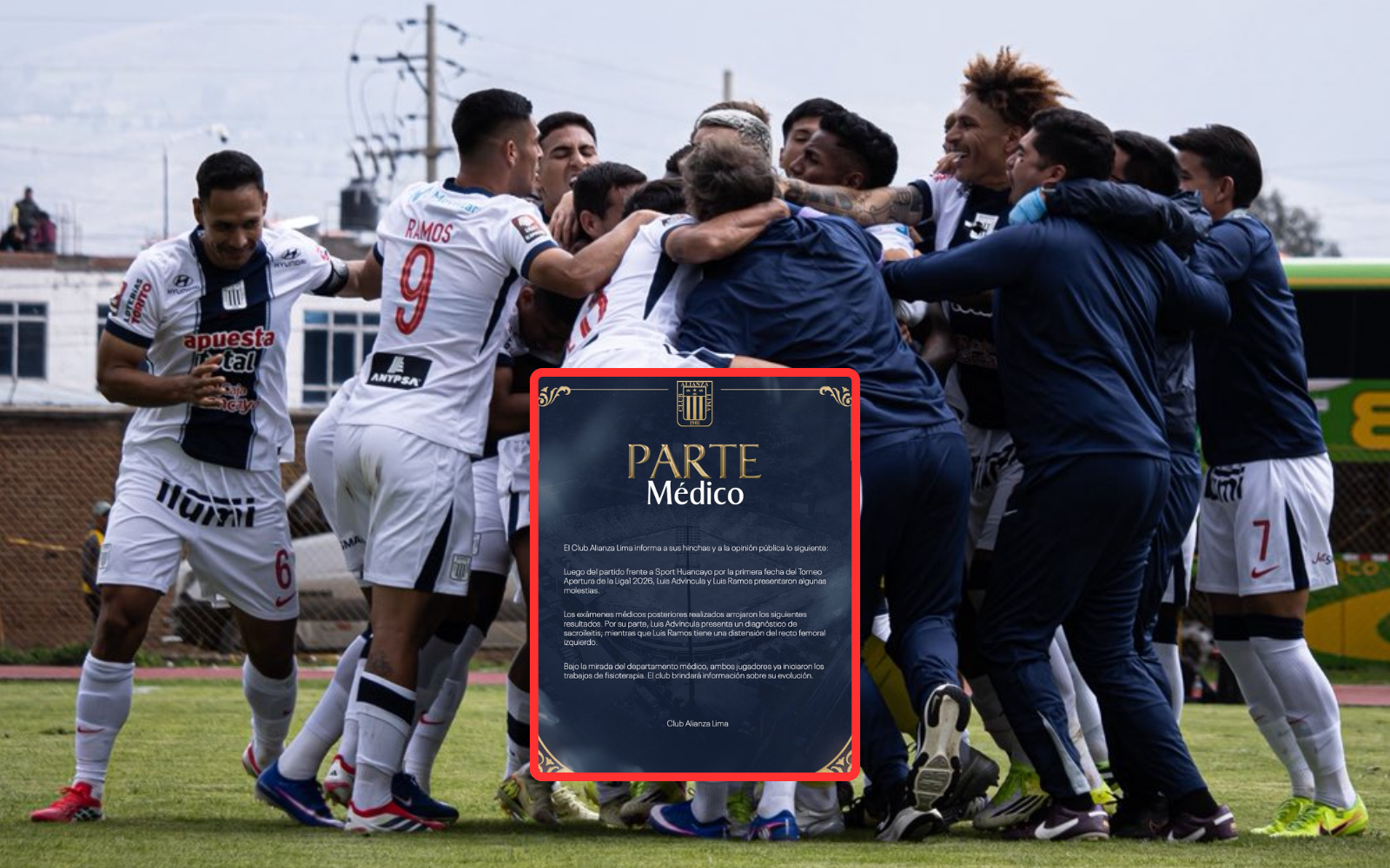 Alianza Lima siete bajas ante club 2 de Mayo