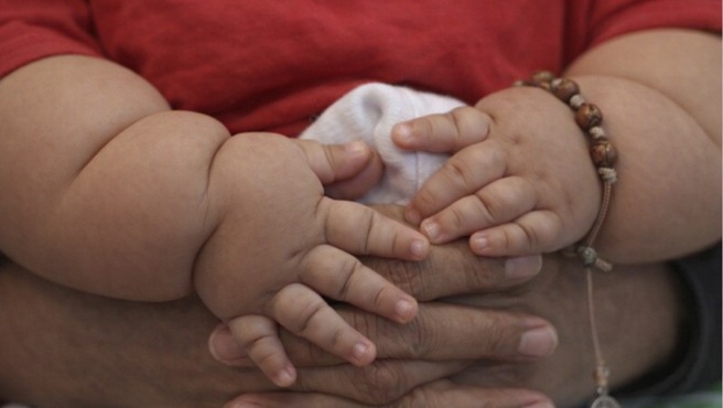 obesidad infantil