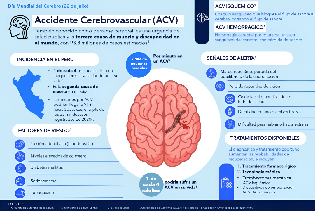 Señales de alerta para actuar rápido ante un ACV