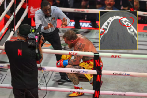 impactante imagen DOBLE FRACTURA sufrió Jake Paul derrota ante Anthony Joshua