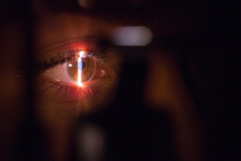 Glaucoma en Perú el ladrón silencioso de la vista que causa ceguera irreversible