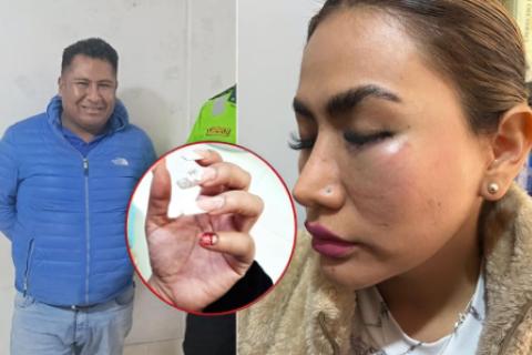 alcalde de tacna detenido por agresion